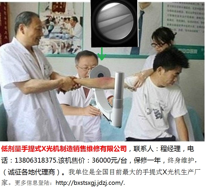 中医正骨用手提式X光机-6