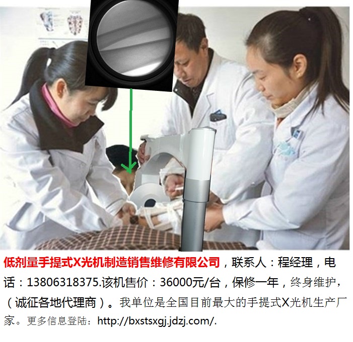 中医正骨用手提式X光机-10