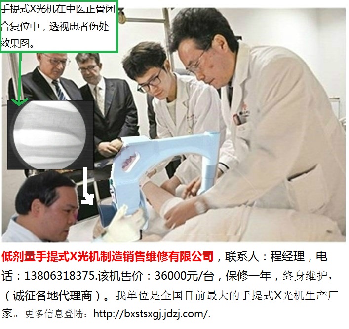 中医正骨用手提式X光机-8