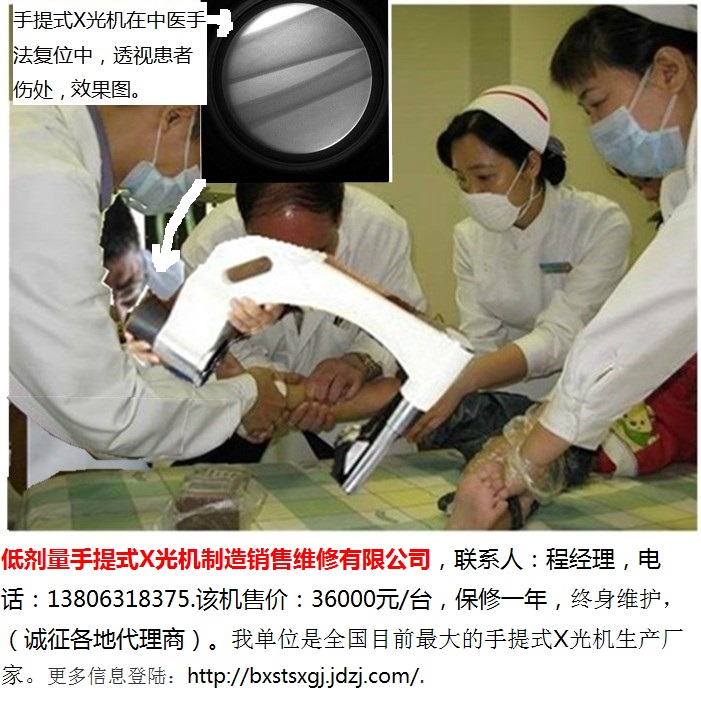 中医正骨用手提式X光机-7