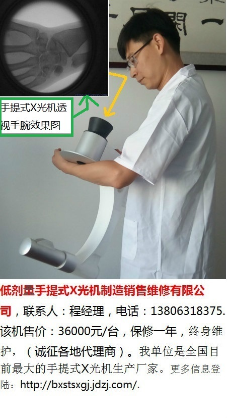 中医正骨用手提式X光机-21