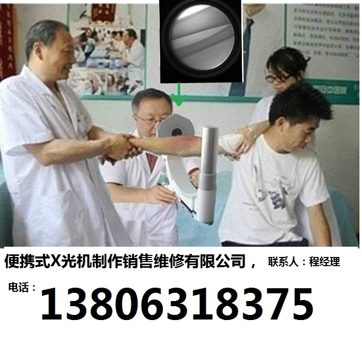 中医正骨用手提式X光机-0-头像