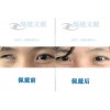义眼片